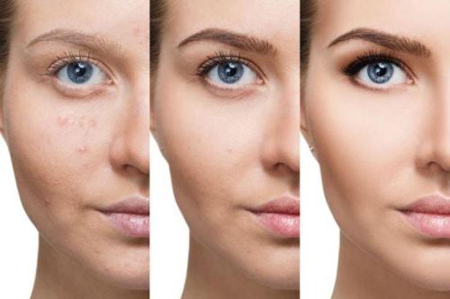 Можно ли добавить личные штрихи, чтобы сделать вечер особенным. Ошибки вечернего макияжа