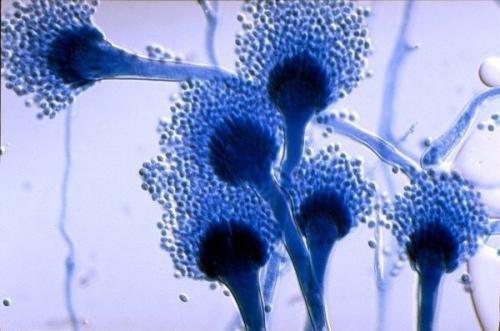 Как избавится от плесени навсегда.
