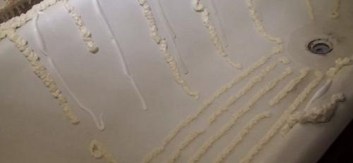 Установка акрилового вкладыша. 07