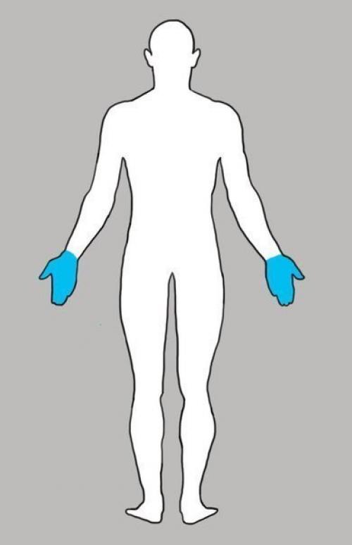 Почему у нас вечно что-то болит: всему есть своя причина? 06 Почему у нас вечно что-то болит: всему есть своя причина? 06